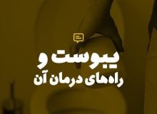 درمان یبوست فقط با استفاده از ملیّنات و مسهلات