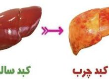 کبد چرب و چگونگی ایجاد آن