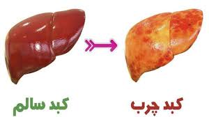 کبد چرب و چگونگی ایجاد آن