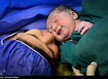 زایمان در بیمارستان خصوصی30تا85میلیون/اختلاف طبیعی و سزارین؟